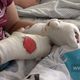 Фото 24-kg.com. Во время беспорядков милиционеры получили различные травмы